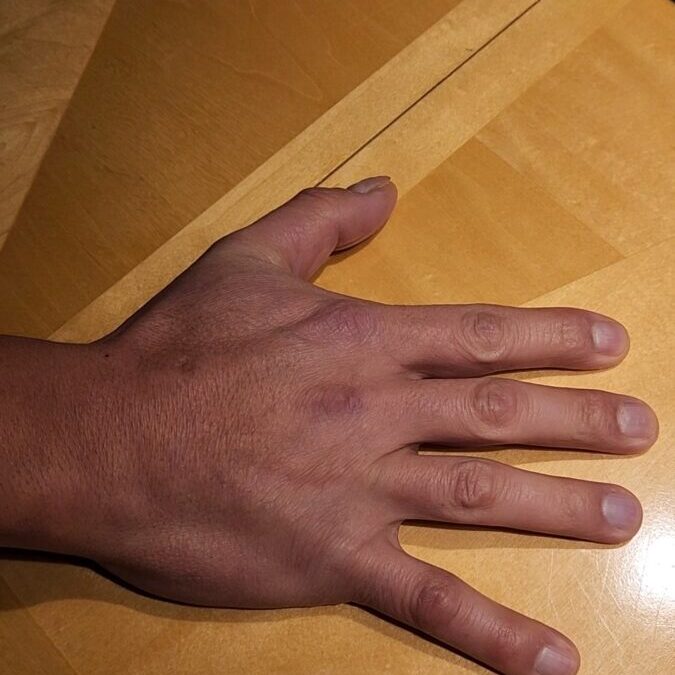 Hand